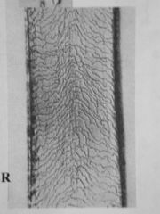 Rat hair properties under the microscope, courtesy McCrone Research Institute cited  & discussed at InspectApedia.com